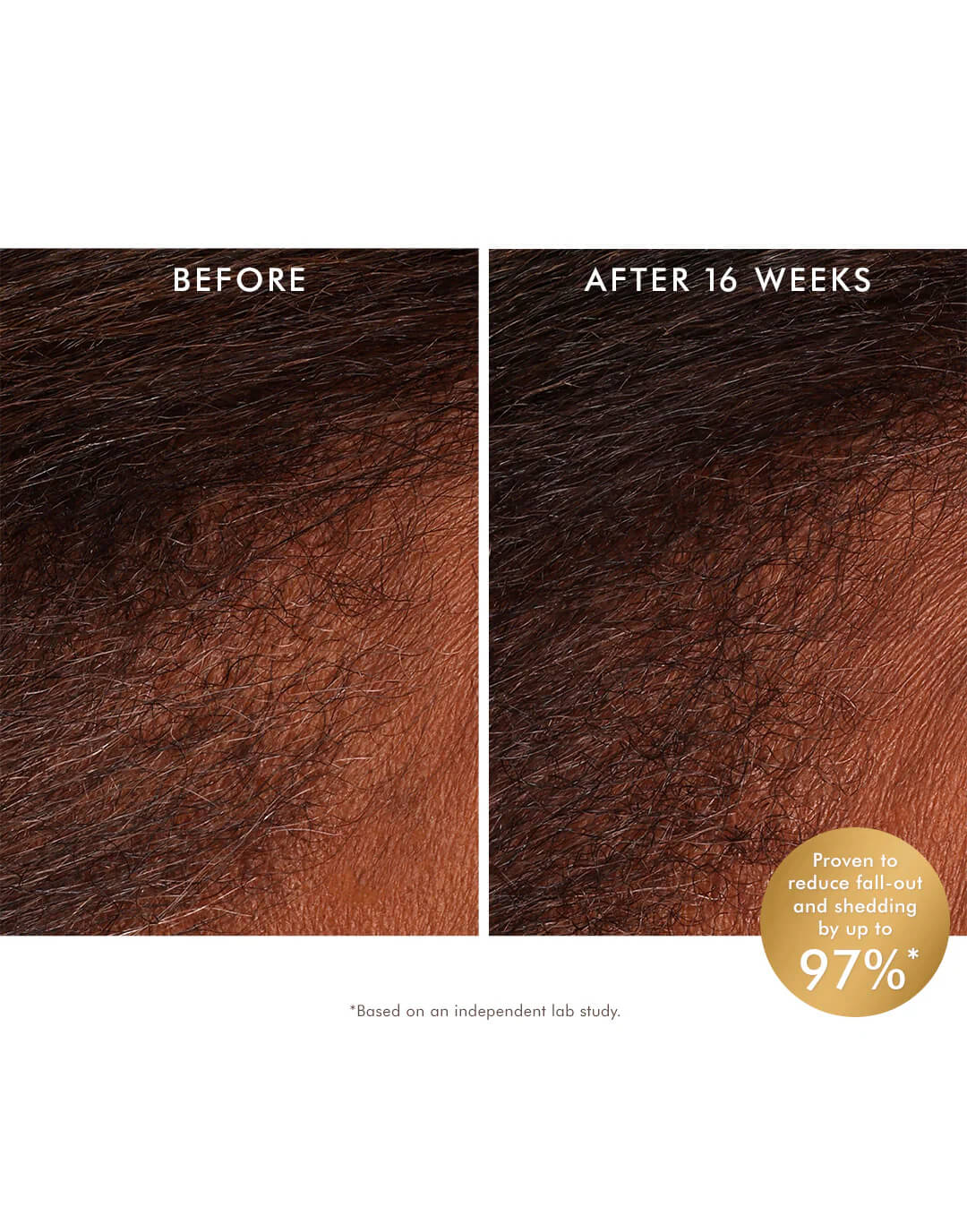 Moroccanoil Revitalizing Scalp Tonic 100ml - Image 3